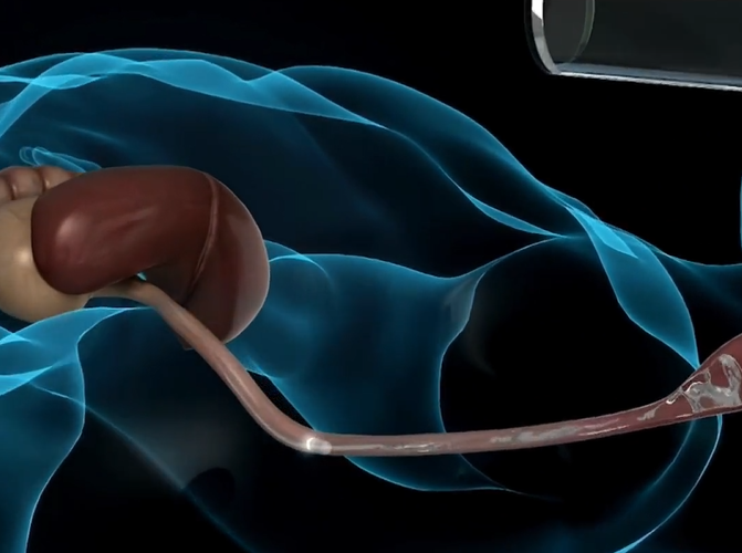 แคปซูลจิ๋วพลัง AI จากจีน พลิกโฉมการตรวจกระเพาะอาหาร ไร้เจ็บรู้ผลใน 8 นาที