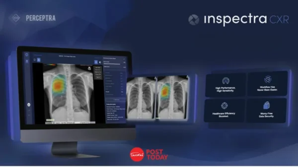 ชู ‘AI Chest X-ray เพิ่มประสิทธิภาพตรวจคัดกรองวัณโรค – มะเร็งปอด’