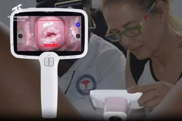 เครื่องตรวจมะเร็งปากมดลูกแบบพกพาด้วย AI รู้ผลใน 5 วินาที ใช้งานได้แม้ในพื้นที่ไร้สัญญาณ