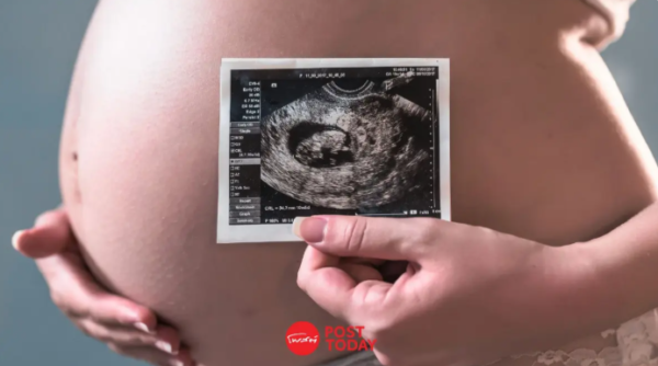 FDA ไฟเขียว! BioticsAI ใช้ AI อัลตราซาวด์ความผิดปกติทารกในครรภ์