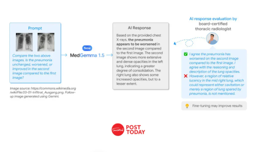 MedGemma 1.5 โมเดล AI อ่าน MRI และ CT จาก Google เปิดให้ใช้ฟรีแล้ว