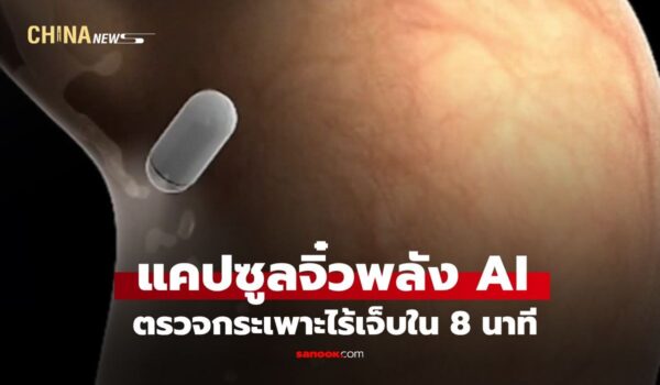 แคปซูลจิ๋วพลัง AI จากจีน พลิกโฉมการตรวจกระเพาะอาหาร ไร้เจ็บรู้ผลใน 8 นาที
