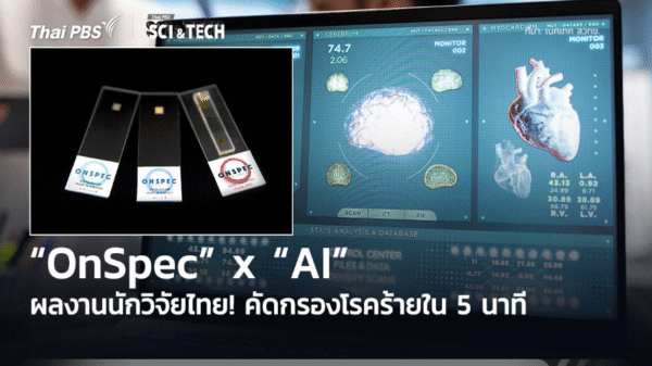 ผลงานนักวิจัยไทย! “OnSpec” x “AI” คัดกรองโรคร้ายใน 5 นาที